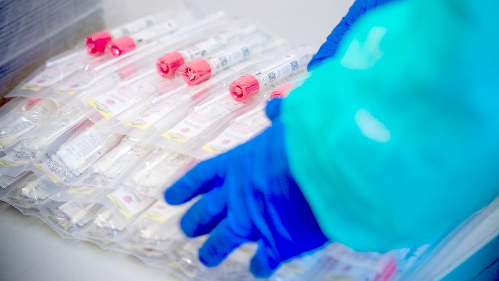 Arbeitnehmer, die nicht geimpft oder genesen sind, müssen sich täglich testen lassen. Foto: Büttner/DPA