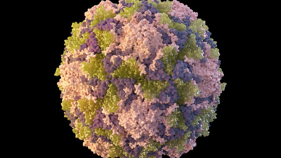 Poliomyelitis ist eine Erkrankung, die vor allem Kleinkinder gefährdet. Während des Krankheitsverlaufes können Lähmungen auftreten – daher auch der Name Kinderlähmung. Eine Therapiemöglichkeit gibt es derzeit nicht. Symbolfoto: dpa