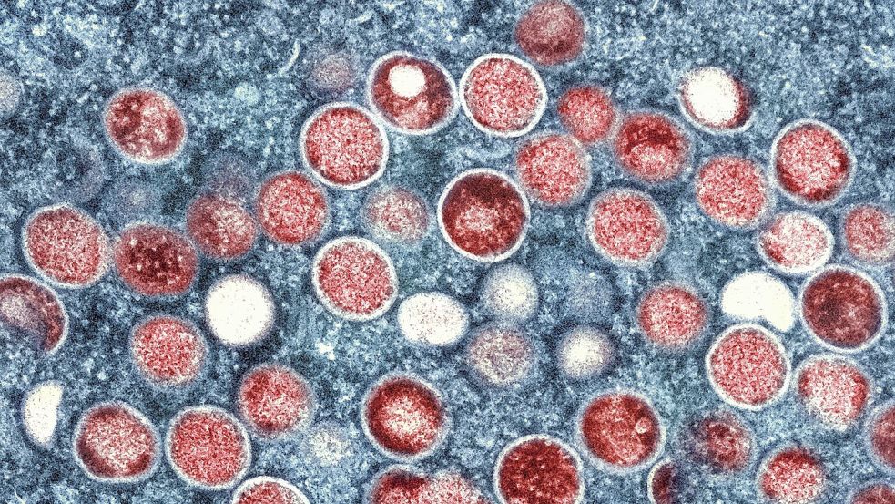 Eine eingefärbte Mikroskopaufnahme von Mpox-Partikeln (rot) in einer infizierten Zelle (blau), die im Labor kultiviert wurde. Foto: -/National Institute of Allergy and Infectious Diseases/dpa