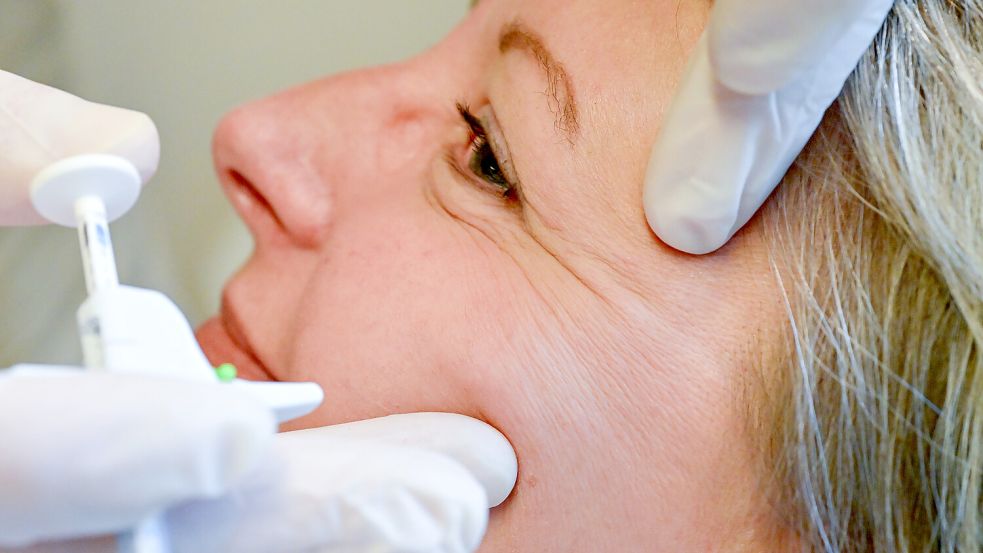 Auch die sogenannten Krähenfüße oder Lachfalten am Auge lassen sich viele Patientinnen und Patienten mit Botox „wegspritzen“. Foto: Klaus Ortgies