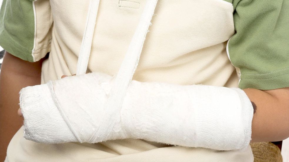 Mit einem Gipsarm kam in den vergangenen Tagen nach einem Sturz auf den schnee- und eisglatten Straße auch so mancher Ostfriese wieder aus dem Krankenhaus. Symbolfoto: IMAGO / Design Pics