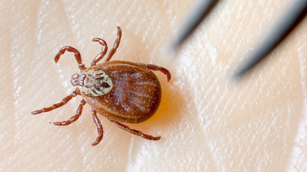Eine Zecke, auch Gemeiner Holzbock genannt, krabbelt über eine Hand, daneben wird eine Pinzette gehalten. Foto: Patrick Pleul/dpa-Bildfunk