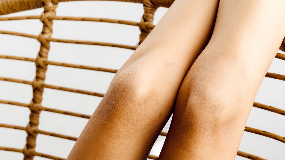 Was man für glatte Beine nicht alles auf sich nimmt. Symbolfoto: Pexels